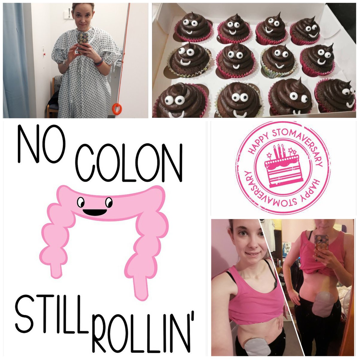 Today is my 3 year stomaversary! Mental how much my mindset has changed in that time. I was so determined to get rid of the bag within months of having it and now I'm on the list for surgery to keep it for life 💪.. 💩cake to celebrate 💖
<a href="/ColostomyUK/">ColostomyUK</a> <a href="/GetYourBellyOut/">#GetYourBellyOut</a> <a href="/iasupport/">IA (Ileostomy and Internal Pouch Association)</a>