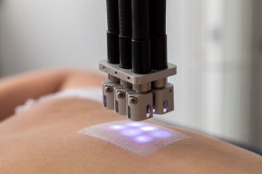 IN VIVO SUNSCREEN TESTMula diperkenalkan lebih 50 tahun lalu, test ni dijalankan ke atas kulit human volunteers. Mereka akan disapu sunscreen, didedahkan pada sinaran UV & kemudian diukur tahap sunburn/suntan mereka.Berapa human volunteers yg digunakan?-Biasanya 5-20 orang.