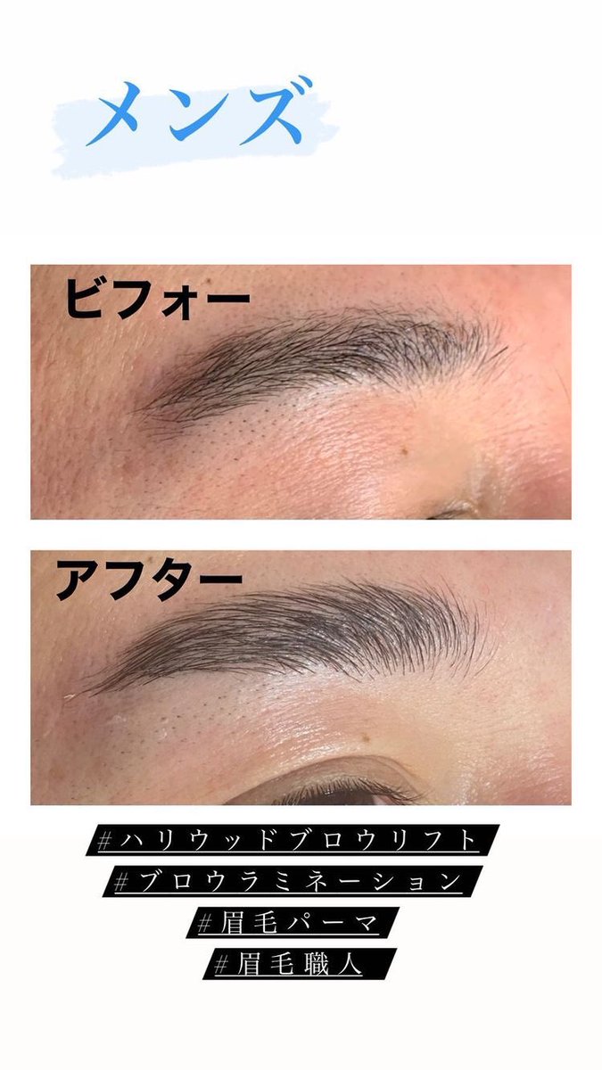 脱毛サロン Lula大宮店 No Twitter メンズ の眉毛も ハリウッドブロウリフト で 毛流れをキレイに カミソリ処理後なので短い 毛が多かったですが 自然な眉毛に 眉毛 フェイシャル Wax アイブロウ Hbl バズり中 大宮 西口 駅前 脱毛 T Co 脱毛サロン Lula大宮店 No Twitter メンズ の眉毛も ハリウッドブロウリフト で 毛流れをキレイに カミソリ処理後なので短い 毛が多かったですが 自然な眉毛に 眉毛 フェイシャル Wax アイブロウ Hbl バズり中 大宮 西口 駅前 脱毛 T Co
