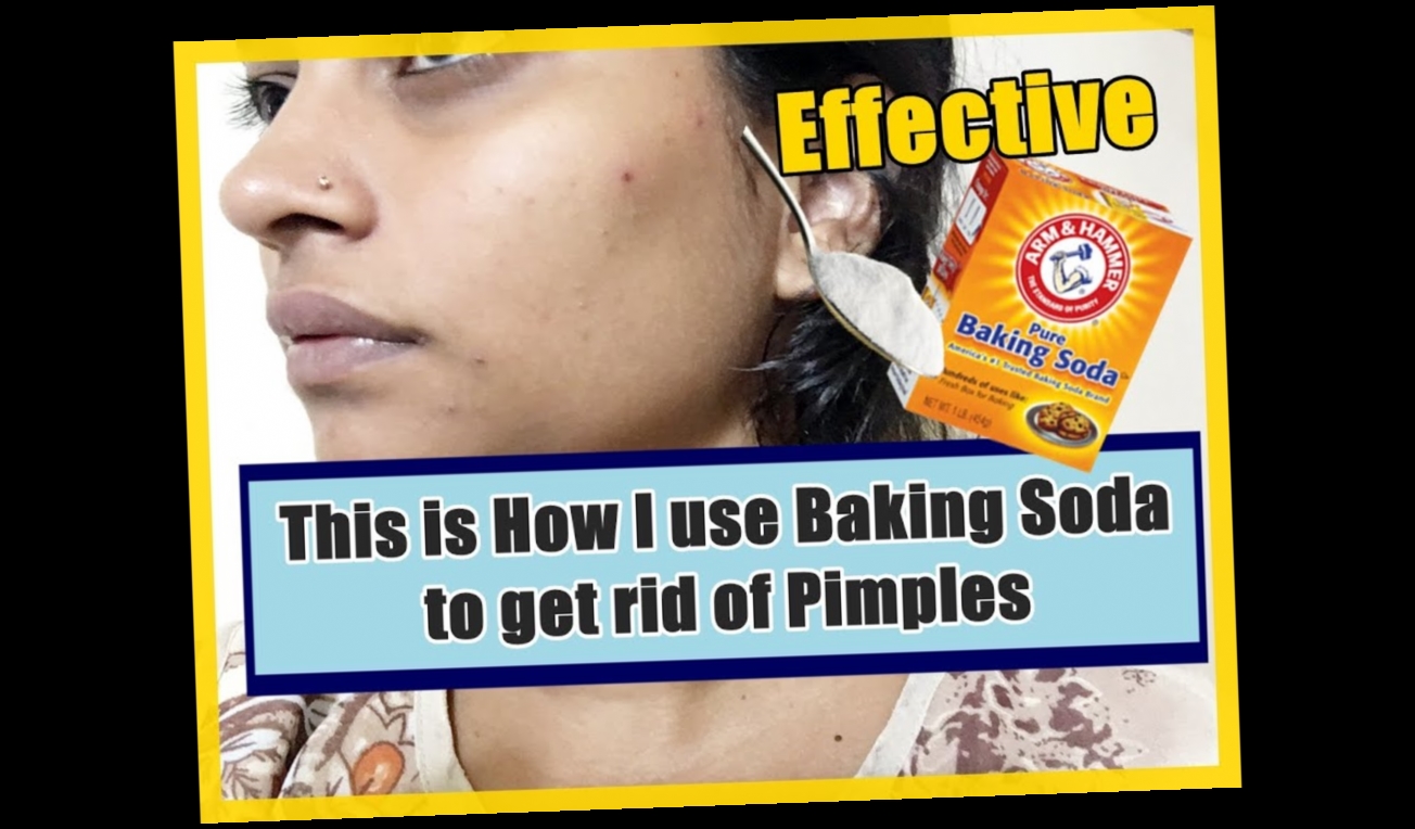 baking soda pimple hack / Twitter