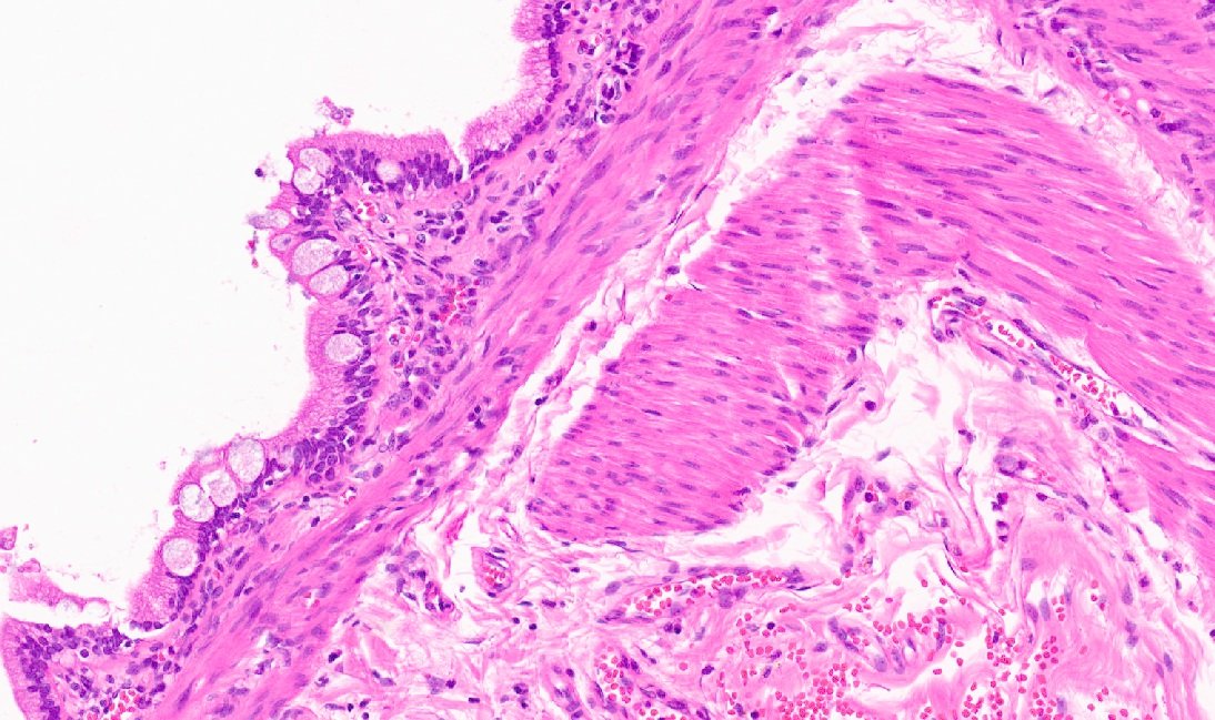 Mukul Vij, MD 🇮🇳 tweet media