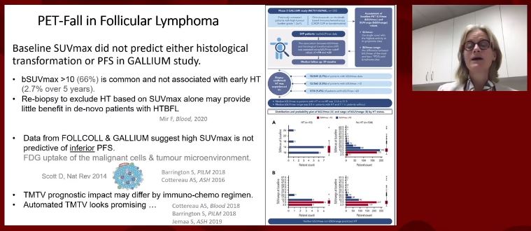 On to follicular lymphoma: EOT-PET is highly predictive of PFS in high tumor burden FL (EOT-PET+ patients have much higher risk of death!). Also interesting: SUVmax >10 was not associated with early HT in GALLIUM study; do we need to rebiopsy this patients?  #ASH20  #lymsm5/5