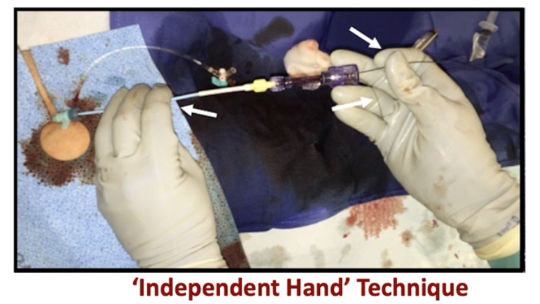 Hady Lichaa, MD, FACC, FSCAI, FSVM, RPVI tweet media