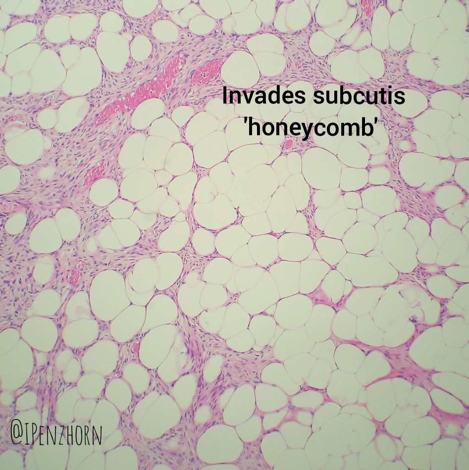 Ingrid Penzhorn tweet media