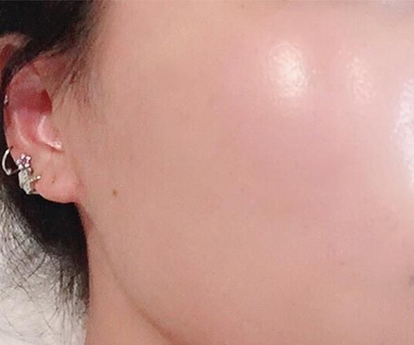 Tips on how to have clear skin — a thread;