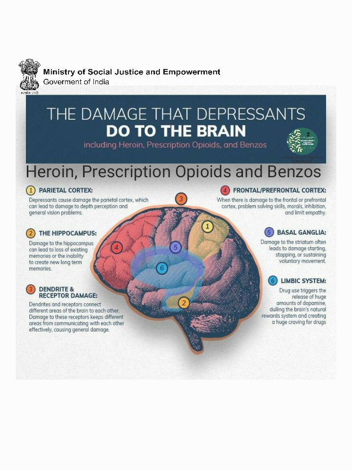 Shareen_Mehnaaz's tweet photo. With @NMBA_MSJE
#NashaMuktBharatAbhiyan #NashaMuktBharatAbhiyanHyd
#Hyderabad #Telengana #Kurnool #andhrapradesh #NMBA #NMBAH #hopefordope #SayNoToDrugs https://t.co/zVyHN5MFAY