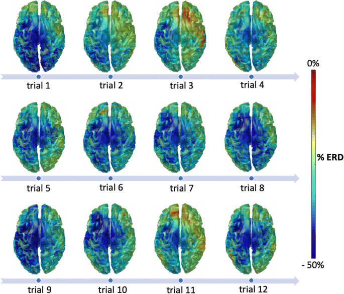 Brain_Products's tweet photo. Analyses of #highdensityEEG data are typically performed offline due to high computational demand. The RT-NET real-time electrophysiology toolbox has been developed for online reconstruction of neural activity using #hdEEG. w/ #actiCHamp #Matlab #LSL 
https://t.co/35xzYp6hpI https://t.co/Szo8I4uQPI