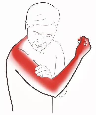 basemhenri's tweet image. اي من الصورتين يمثل الالم الذي تشعر به ؟ 

شاركنا و سنقوم بمناقشة الالم و سببه و طرق علاجه 

ريتويت  🔁                      لايك ❤️