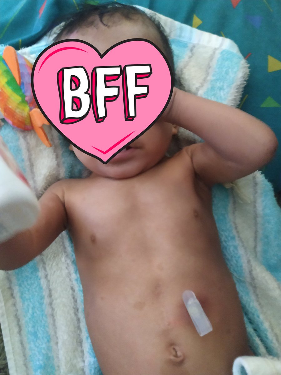 SyahiidOthman's tweet photo. Salam mohon RT tweet saya,sejak anak saya lahir,isteri tak dapat berkerja,anak saya dilahirkan tanpa esophagus,tiada babysitter yang sanggup jaga,duit gaji hanya cukup bayar komitmen @PejuangJlnLurus @OwToTheZie @ohtweet https://t.co/tVADYjKW9w