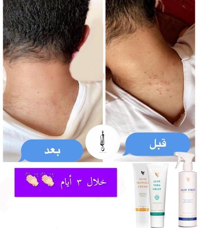 DenaSayed10's tweet image. علاج حب الشباب والاكزيما من احد تجارب العملاء الكرام للطلب حاكيني خاص او تم #يوم_الجمعه
#lacasadepapel4
#قابوس_بن_سعيد
#سلم_علي
#عمان_جسد_واحد
#مطرح
#درب_السلامه
#الطيران_العماني
#الطيران_القطري
#المملكه_العربيه_السعوديه
#covid_19
#💐🌼