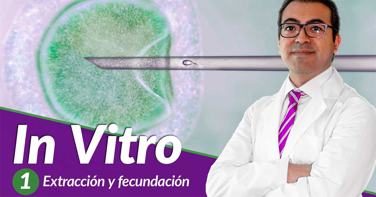 Que significa fecundacion in vitro