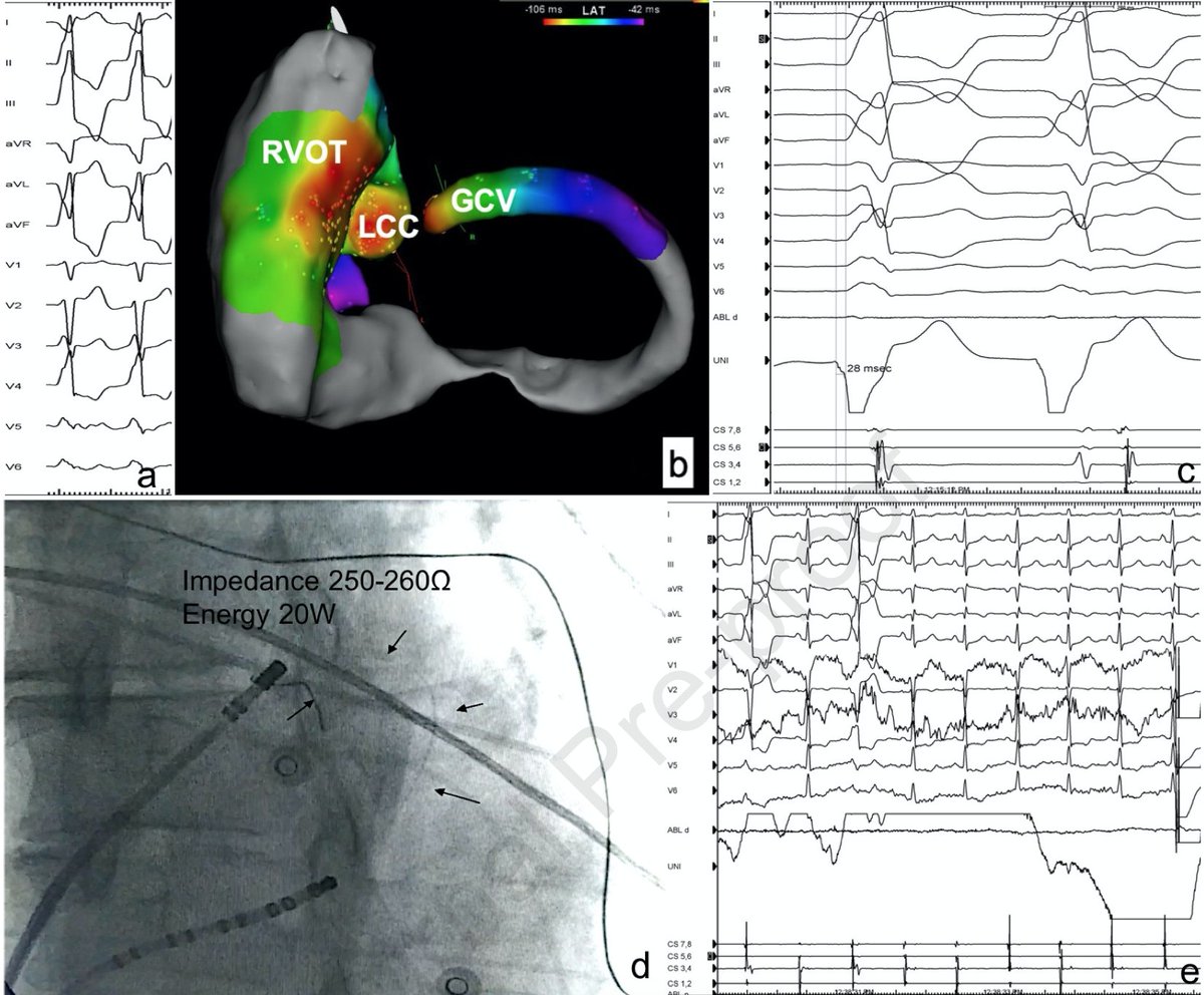 Heart Rhythm Case Reports tweet media