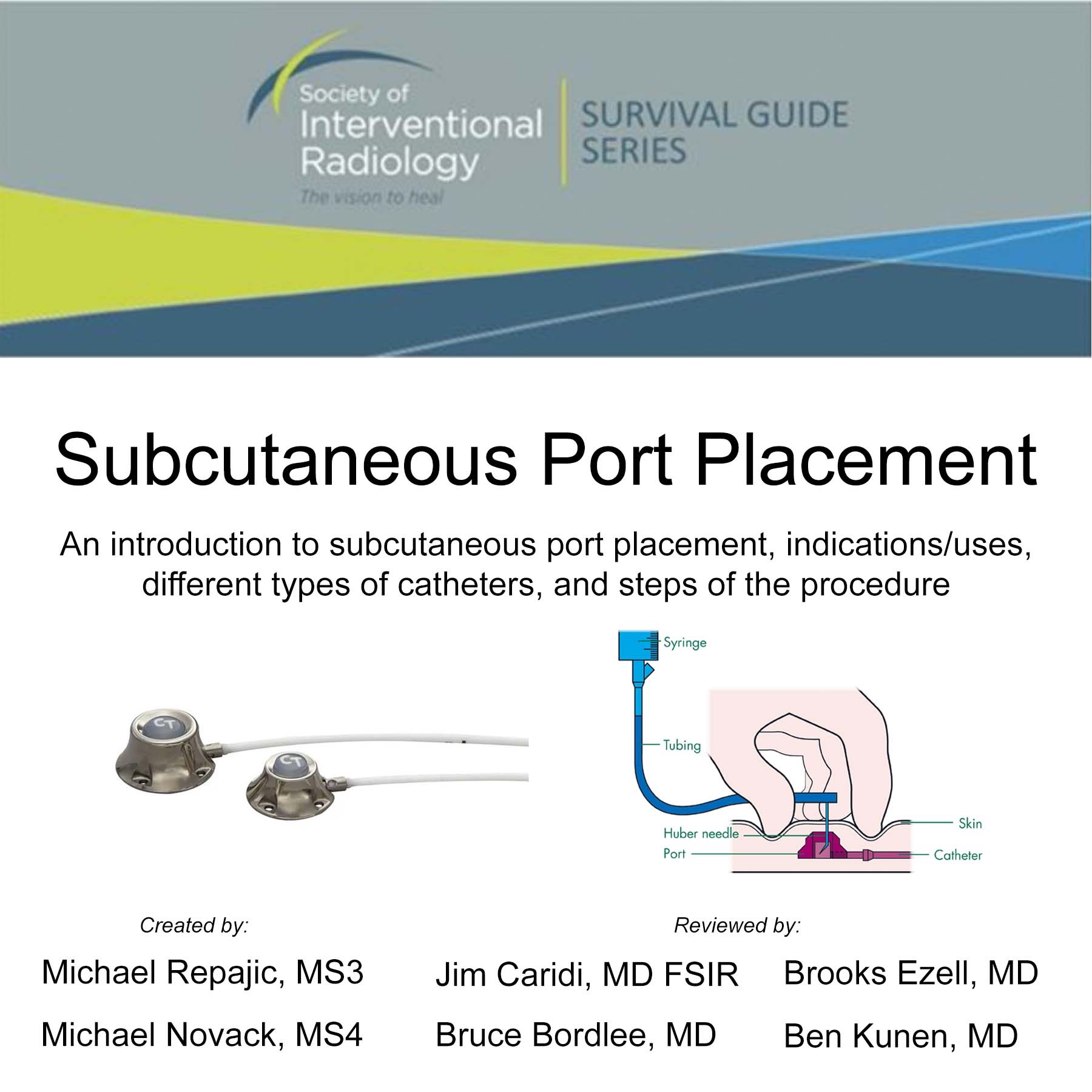 SIR RFS on X: IR Procedure Starter Kit Subcutaneous port placement (eg:  port-a-cath) is a procedure that involves the placement of an implanted  device with the tip positioned at the cavoatrial junction