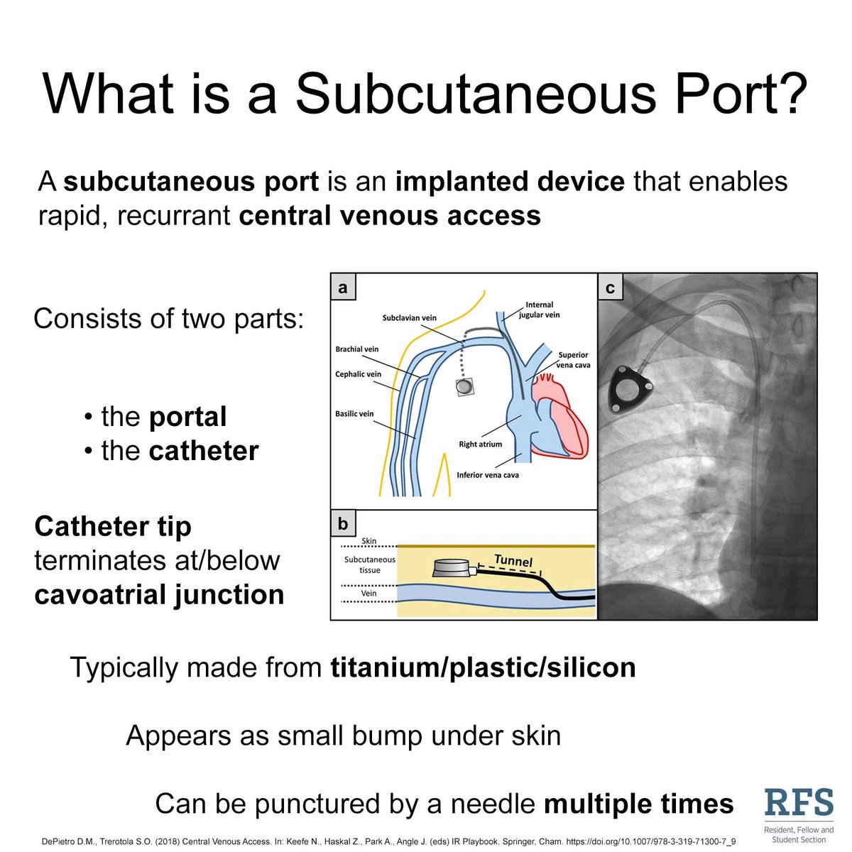 Locations for port placement - DocCheck