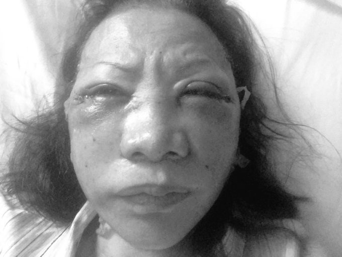 DeskaTengku's tweet photo. @fadlizon Jangan mudah percaya bang, belajar dari pengalaman, dulu Abang juga yg paling cepat percaya, dan menggiring opini bahwa Ratna Sarumpaet di Bantai, tapi kenyataannya apa bang ? "Kebohongan tingkat Dewa" https://t.co/zTjSIpN9zR