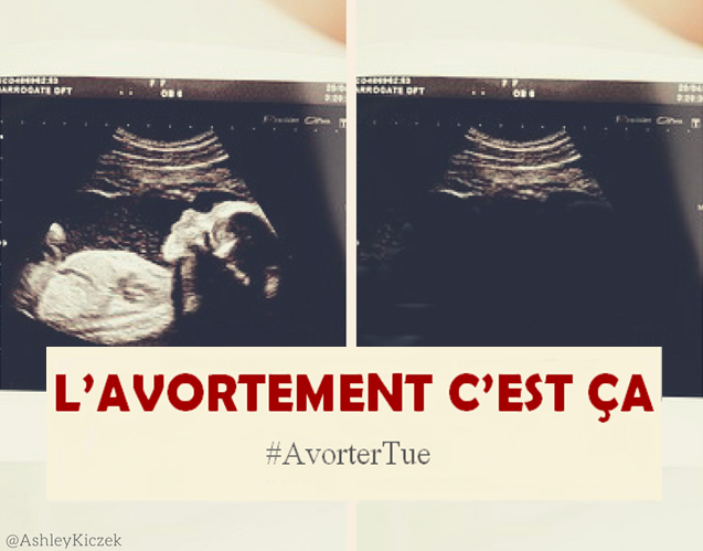 LatifaHamda's tweet photo. @BigSuis Non M. le troll anti-enfant à naître, vous avez surtout loupé une occasion de respecter la vie humaine et toutes ces mères qui chaque jour sont poussées à commettre l'irréparable. https://t.co/5ta5Mmo31f