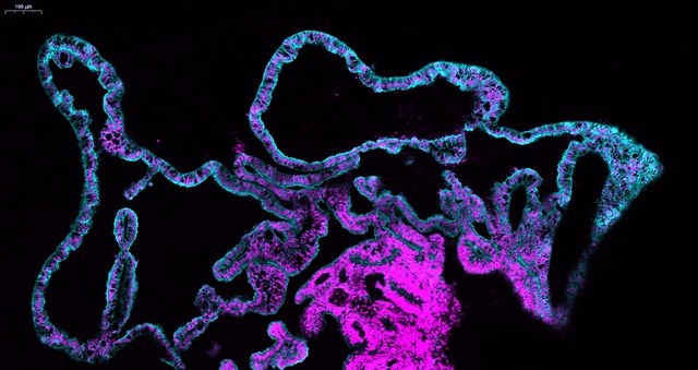 Co_Biologists's tweet photo. On day 8 of #BiologistsAdvent, we're off to @the_Node to feast our eyes on @laurapellegrini's rather lovely confocal image of a human choroid plexus organoid.
🎄Tinsel, anyone…? https://t.co/z9X4eMO4Xc