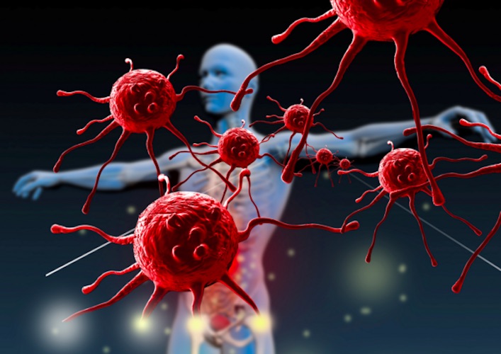 Prevenire è meglio che curare! 👩‍🔬

Lo sai che si stima che nel corso della vita un uomo su 2 e una donna su 3 si ammalerà di #cancro? 😷

Ne parleremo il 15 Dicembre alle ore 21 con Francesca Demichelis 👩‍🔬
⏰➡️ youtu.be/i920_cqr3eo

<a href="/Ragionevo1Mente/">RagionevolMente</a>