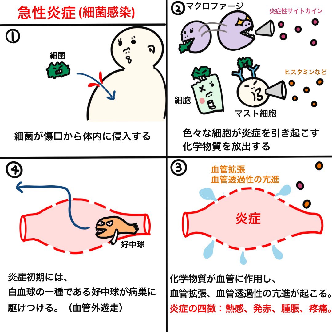 ゴロ 解剖生理イラスト Twitterissa 8コマ漫画で分かる 急性炎症