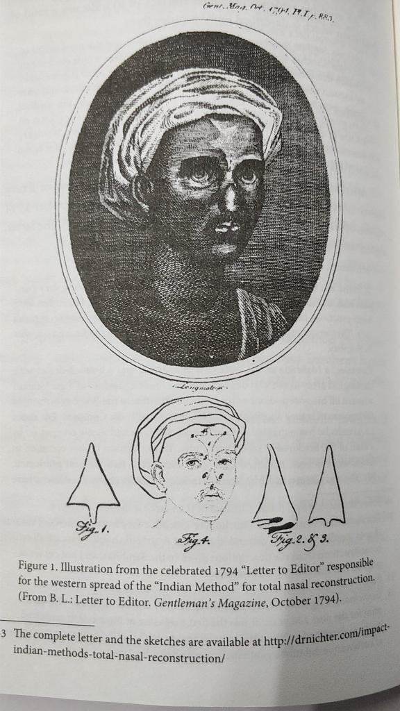 British surgeons are using Sushrut's plastic surgery technique since 1700.
Support Integrated One Nation &amp; Integrated Medicine.