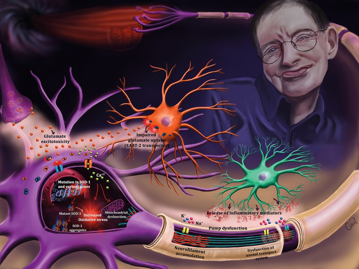 ImagenScience's tweet photo. #ImagenScienceadventcalendar: Dec 8th

The illustration mixes the abstract image of a weakening muscle disappearing into a black hole with the molecular details of the causative pathologies of #ALS in the neurons.  Looking on is the great Stephen Hawking
Thank you @gokcetaniyan https://t.co/jWtauHG9Fq