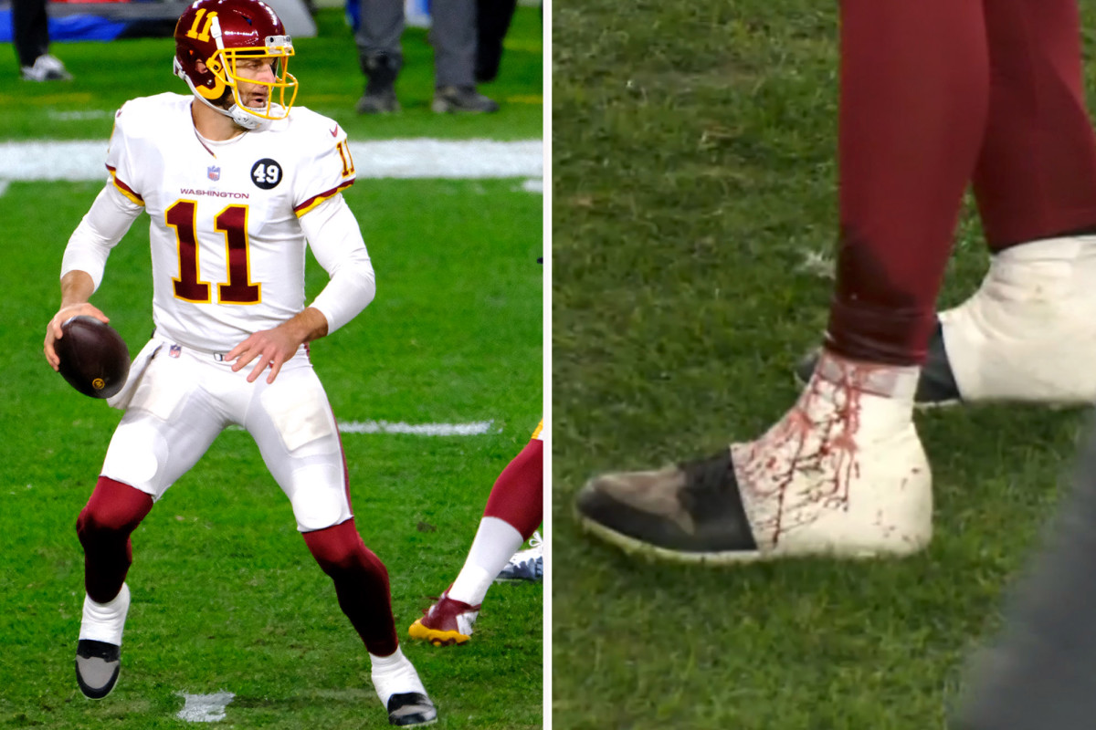Alex Smith's legend grows with bloody sock