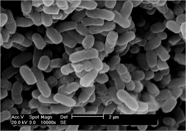 huevofritologa's tweet photo. Las bacterias acéticas, del género Acetobacter, son conocidas por picar o avinagrar el vino. En presencia de alcohol y oxigeno son capaces de oxidar este compuesto y producir ácido acético. Esta reacción es deseada en la elaboración de vinagre, pero no en la del vino #MicroDato https://t.co/GYn3MK7bKd