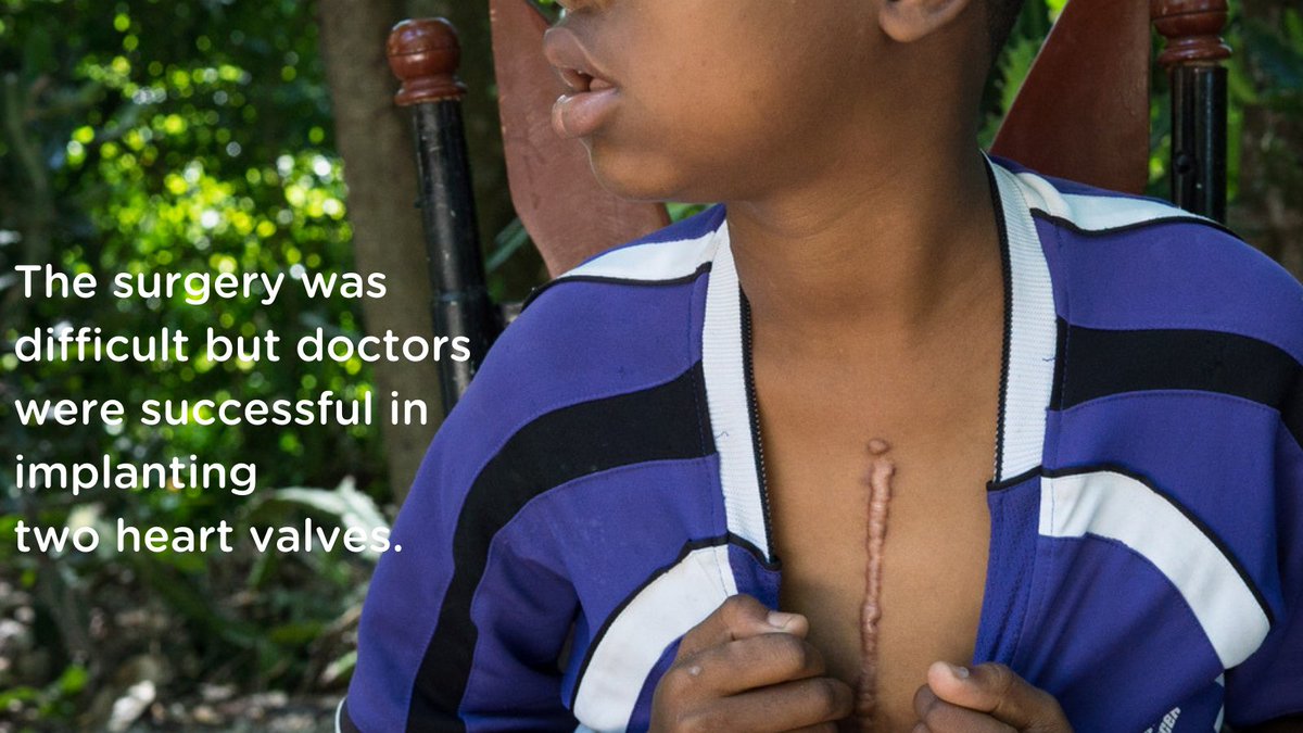 Woodyson's surgery was very difficult, but doctors succeeded in implanting two mechanical valves. His heart slowly regained the function it had lost while he was sick, and he gained weight and strength. #Haiti #PediatricCardiology