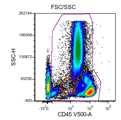 (1/8) The many faces of APL: This is a challenging/educational case shared with us last week by  @SaWangMD Below in the plot, on CD45 and SCC no apparent blasts population is identified (red circle) #hemepath  #PathTwitter  @LeukemiaMDA  @KirillLyapichev  @sanamloghavi  https://twitter.com/SibaElHussein/status/1336376501802061826