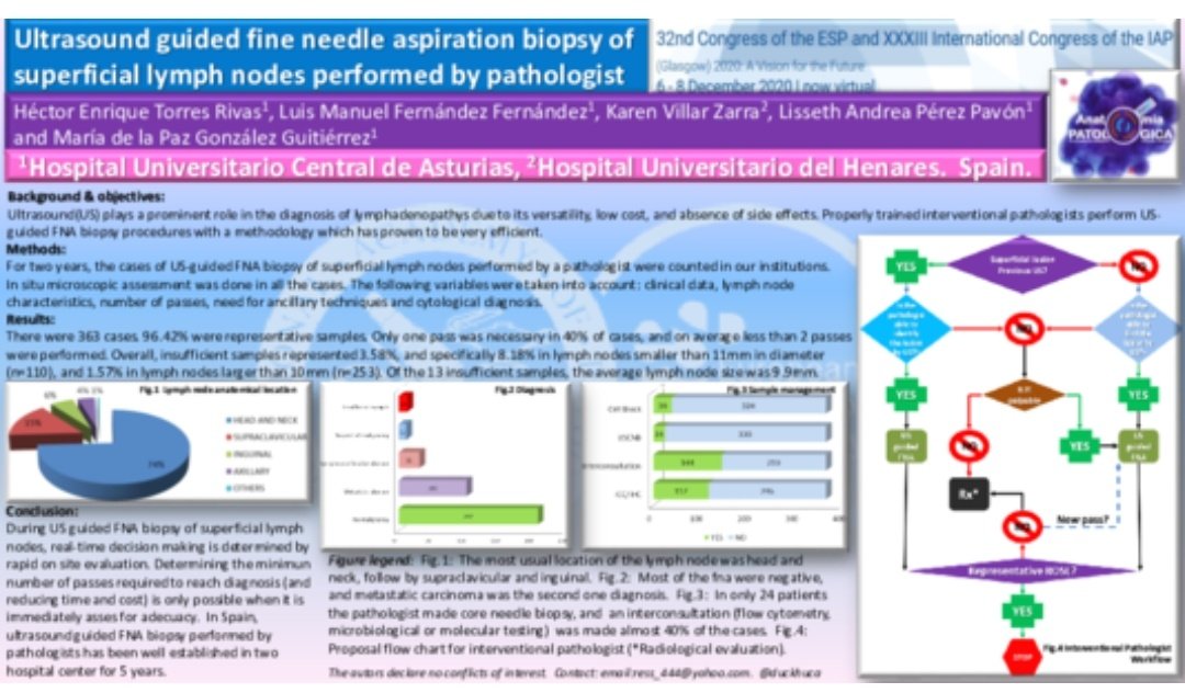 USFNA_SPAIN's tweet photo. #interventionalpathology is about getting the right sample in order to make a #diagnosis. The #interventionalpathologist makes real-time decisions with #ROSE and this is what's about the last poster presented at @esp_congress @duckhuca #USFNA_SpainTeam #virtualpathology2020 https://t.co/SaAIihyu8g