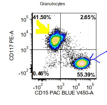 (6/8) Going back and analyzing the granulocytic gate, a distinct APL population that is CD15- and CD117+ is detected (yellow arrow, typical APL) vs CD15+ granulocytes (blue arrow) #hemepath  #PathTwitter