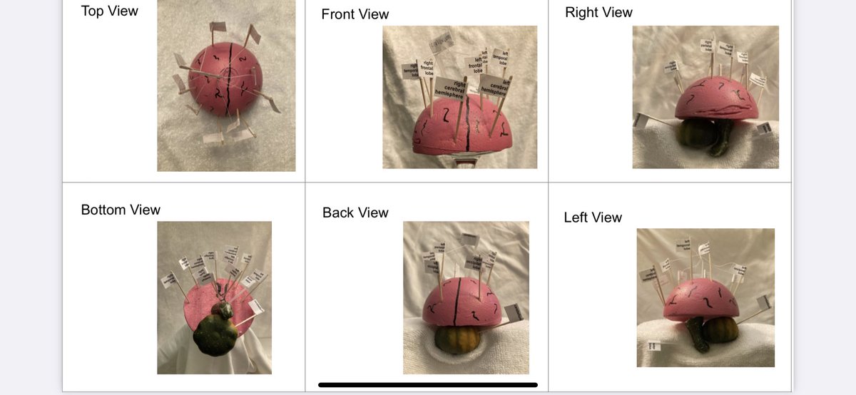 scullotta22's tweet photo. When you can’t be together to dissect real brains🧠, you make one to dissect yourself! Some of the awesome student create brains for our nervous system unit! #bhmsSTEM #bhwarriorpride #llawarrior #pltw #medicaldetectives #8thgrade #elearning #braindissection https://t.co/6NvvFbyKyf