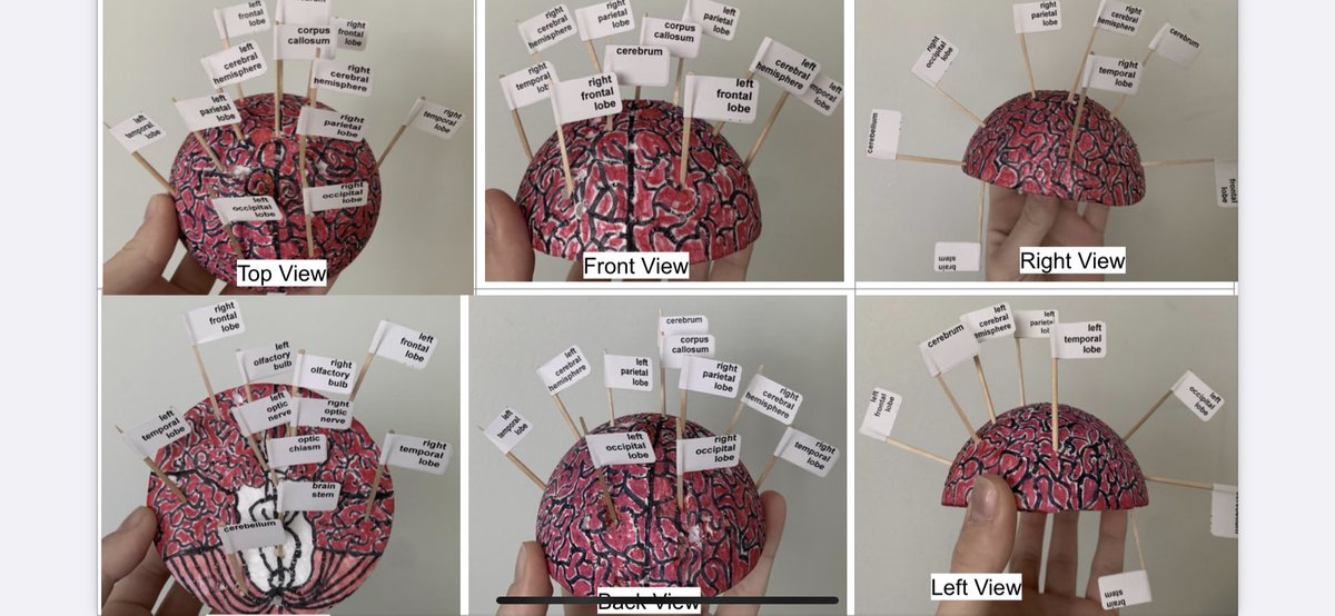 scullotta22's tweet photo. When you can’t be together to dissect real brains🧠, you make one to dissect yourself! Some of the awesome student create brains for our nervous system unit! #bhmsSTEM #bhwarriorpride #llawarrior #pltw #medicaldetectives #8thgrade #elearning #braindissection https://t.co/6NvvFbyKyf