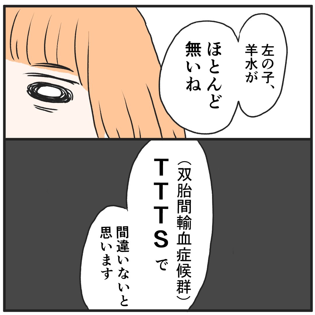 双胎間輸血症候群になった話(2)
#双胎間輸血症候群
#TTTS
#双子
#出産レポ 