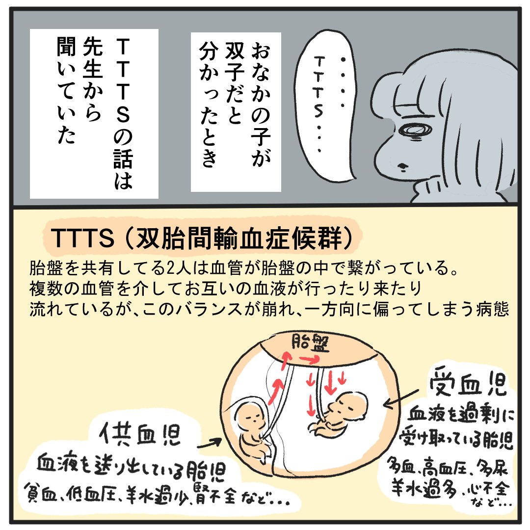 双胎間輸血症候群になった話(2)
#双胎間輸血症候群
#TTTS
#双子
#出産レポ 