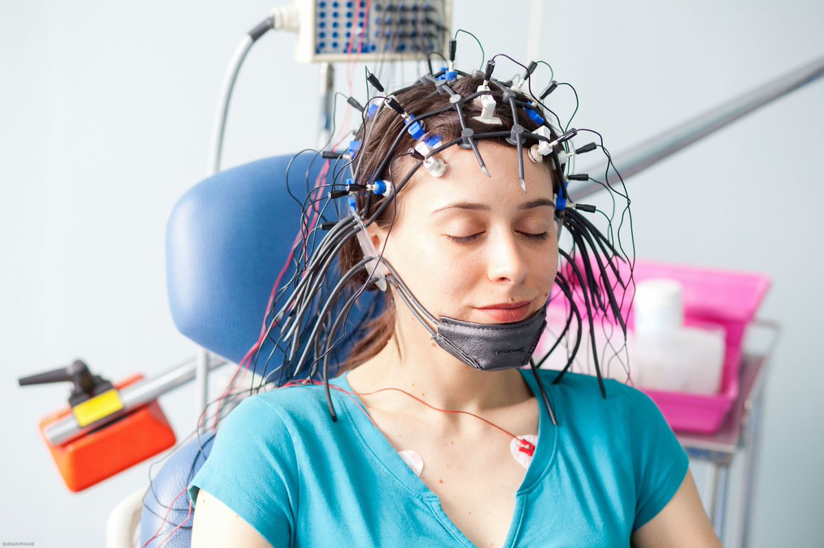 And how do they find epilepsy, you ask? Good question! They use an electroencephalogram, or EEG for short. Basically they stick a bunch of electrodes on your scalp (it doesn’t hurt) and measure your brain activity. The electrodes look like this: 11/