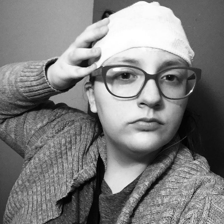EEGs can take place in a doctor’s office or at home, and they can take different lengths of time. I’ve had 1-hour EEGs at doctors’ offices and 24, 48, and 72-hour EEGs at home. Here’s me during a 72-hour EEG, at home. (They put a small stretchy cap over the electrodes.) 13/