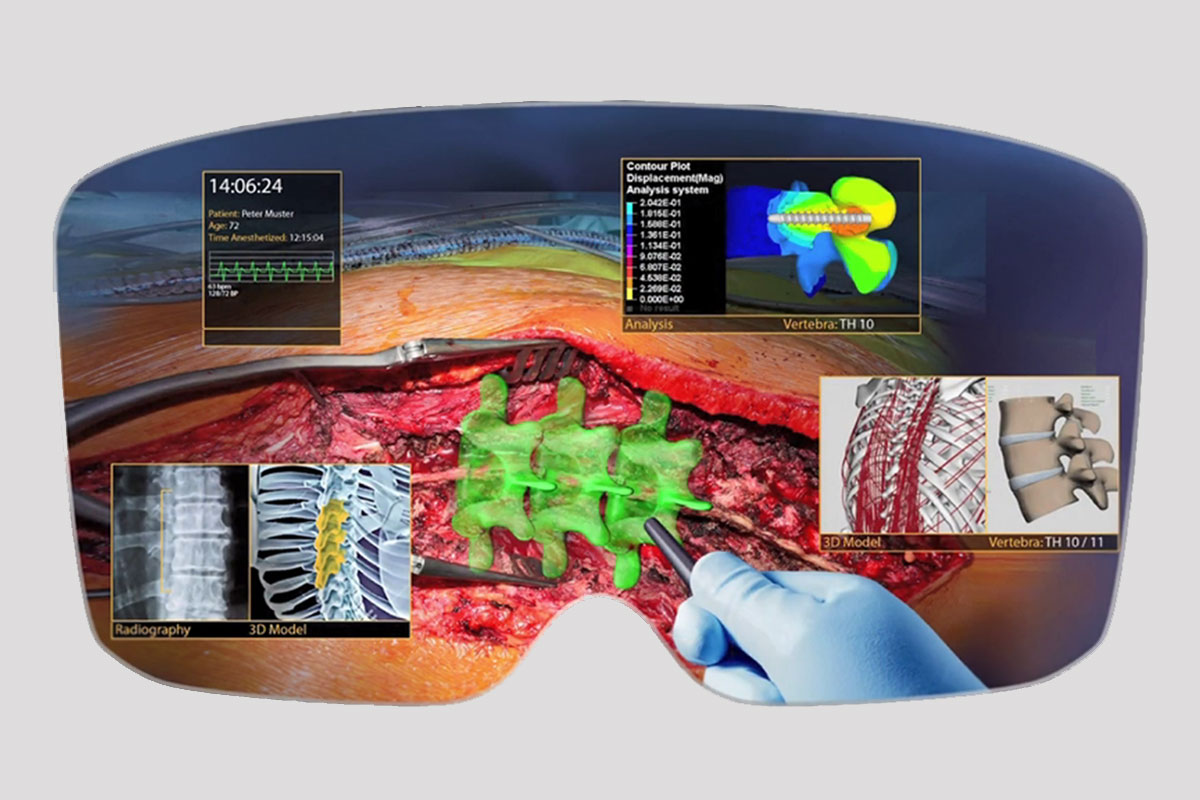 derbalgrist's tweet photo. Unser #WrapUp zum Thema #Digitalisierung an den #Digitaldays2020 @dgt_switzerland. Dank Computertechnologien wie #AugmentedReality werden Operationen präziser und sicherer, die Behandlungsqualität für Patienten steigt.
Aktuellster Blogbeitrag↙️
https://t.co/vqxCaPT1q4 https://t.co/BukfzdSemu