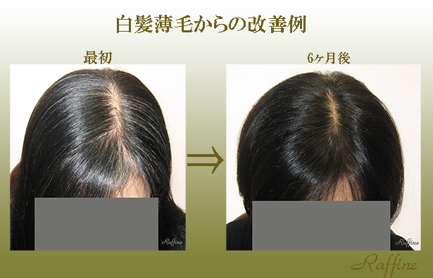ラ フィーネ京都公式 最近 白髪サプリや白髪シャンプー 白髪が治る育毛剤と称する宣伝に要注意 どれも根拠のない宣伝ですよ もし お悩みでしたら フリーダイヤルを 01 751 586 T Co F2j3ligdmc T Co Hjsjwsspvk Twitter ラ フィーネ京都公式 最近 白髪サプリや白髪シャンプー 白髪が治る育毛剤と称する宣伝に要注意 どれも根拠のない宣伝ですよ もし お悩みでしたら フリーダイヤルを 01 751 586 T Co F2j3ligdmc T Co Hjsjwsspvk Twitter
