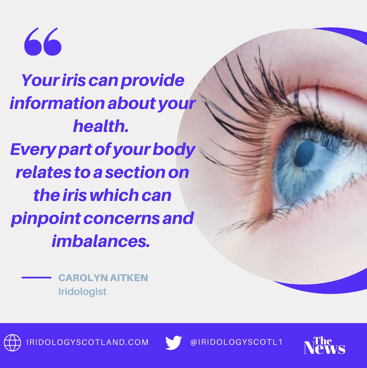 IRIDOLOGYSCOTL1's tweet image. Iridologists can spot potential health concerns before these become issues.