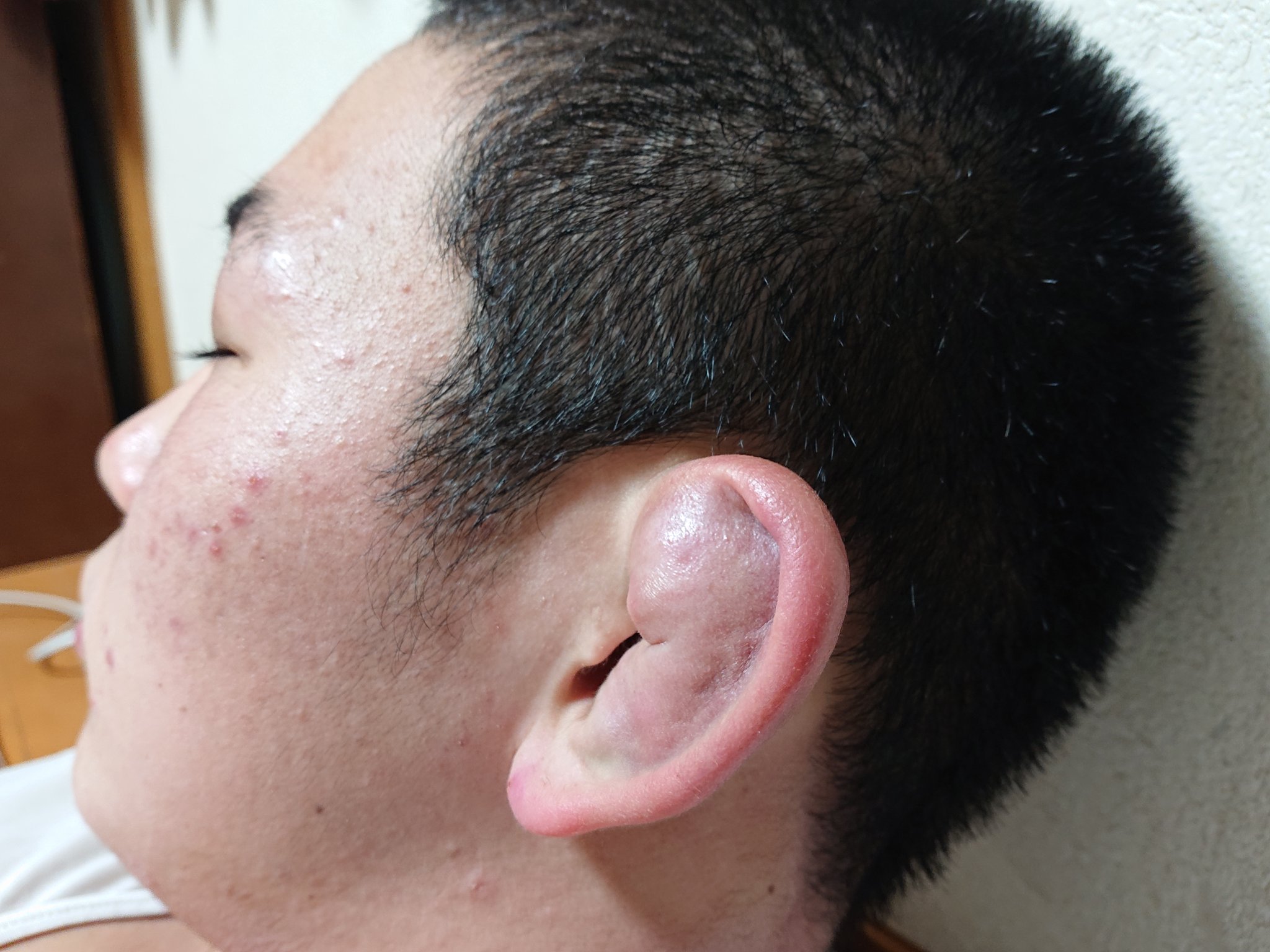 M K 佐助 疲れて寝てる 三男坊もやっと柔道家らしくなってきたな 笑 柔道 Judo 耳 血腫 T Co Qr1yyiob10 Twitter