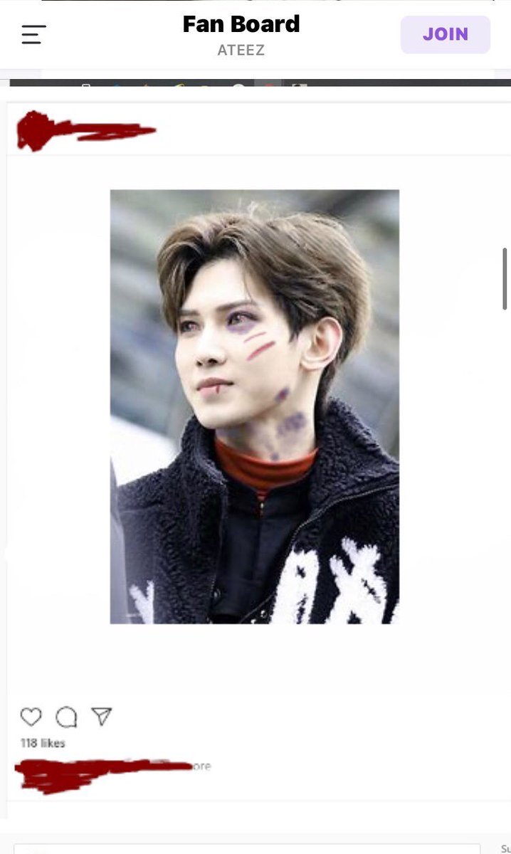 Tw// fake death edits, blood, bruisesY lo más perturbante es que las personas están editando sus fotos con él sangrando, con moretones y muerto