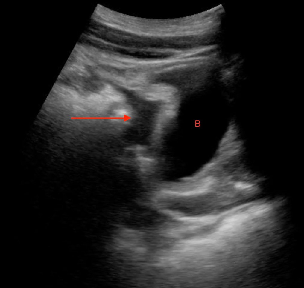 EMNews's tweet photo. .@EMNSpeedofSound has seen thousands of #ultrasound scans in her trauma center, many good, some bad, some ugly, which prompted her to write these 10 commandments of the #FASTexam #FOAMed #FOAMus https://t.co/rBrjh54VBI https://t.co/rBpVG2siGw