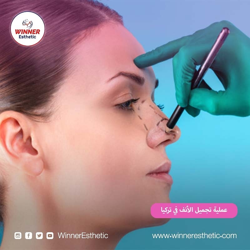 يجري مركز #وينر_اسثاتيك الطبي عملية #تجميل_الأنف في #اسطنبول
احترازات وقاية #كورونا
للتواصل معنا على:
00905385465111
wa.link/q1frji
لزيارة موقعنا الالكتروني: winneresthetic.com
#الامارات #المنامة #العرق #بغداد #الرياض #السعودية #دبي #ابو_ظبي #البحرين #قطر #الدوحة