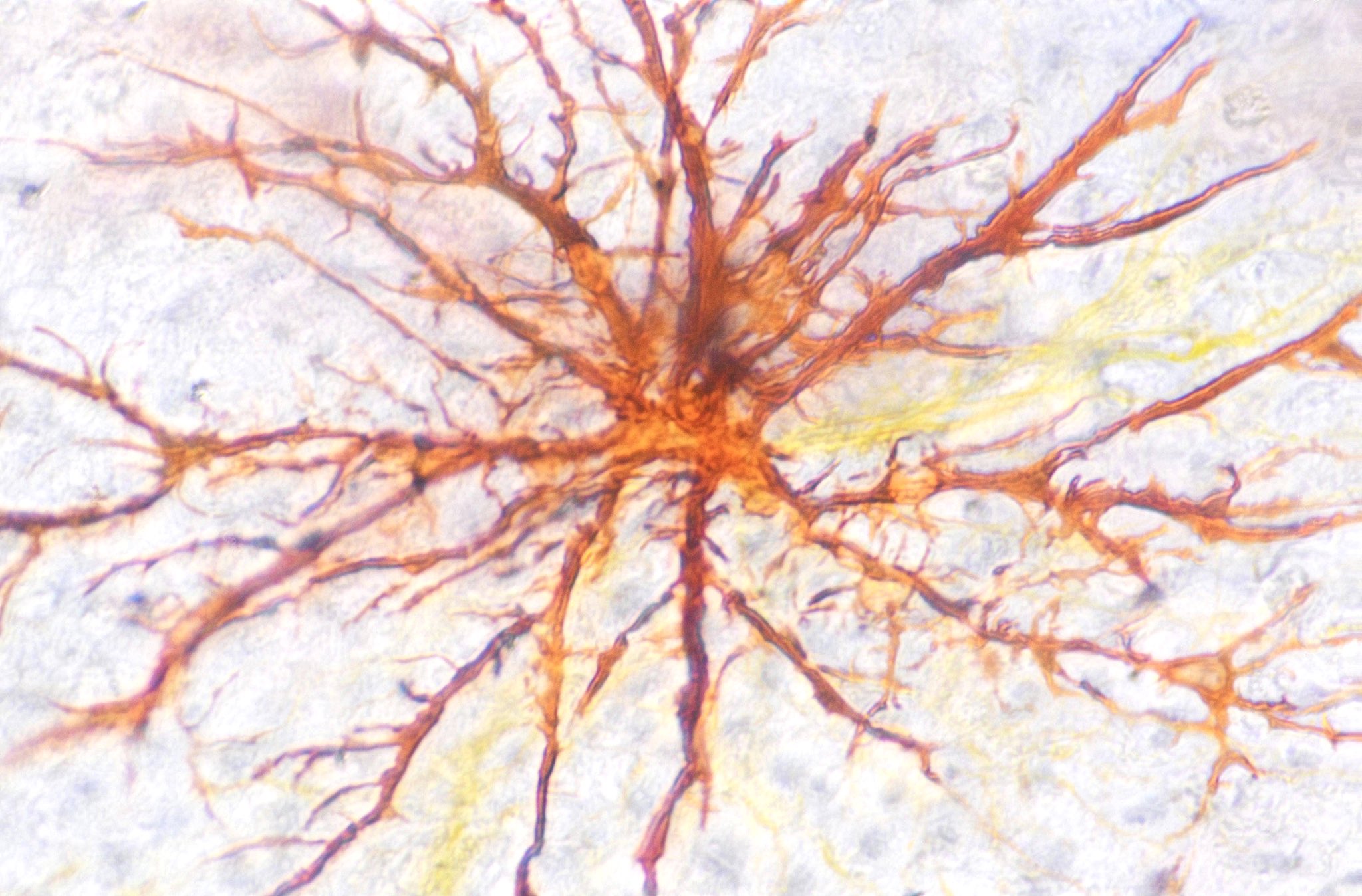 色素胞 Twitter Search Twitter