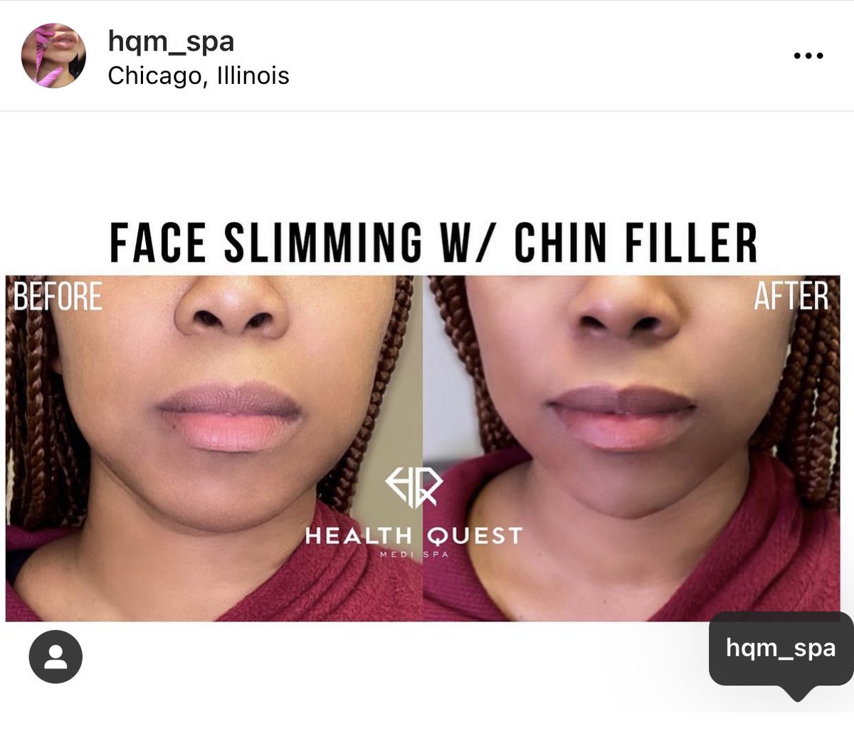 HQMspa's tweet photo. #chicagomedspa https://t.co/1UBszMrf03
