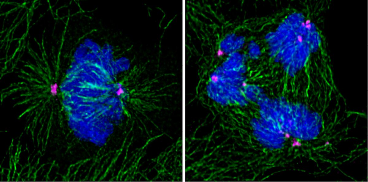New study led by <a href="/CIBIO_UniTrento/">CIBIO - UniTrento</a> <a href="/UniTrento/">Università di Trento</a> published today in <a href="/embojournal/">The EMBO Journal</a>: anomalies in #cell division could help to understand cell errors leading to #tumors. Congrats to <a href="/LucaFava14/">Luca Fava</a>, leader of the research and #ArmeniseHarvard awardee! 👨‍🔬🔬⤵️
embopress.org/doi/full/10.15…
