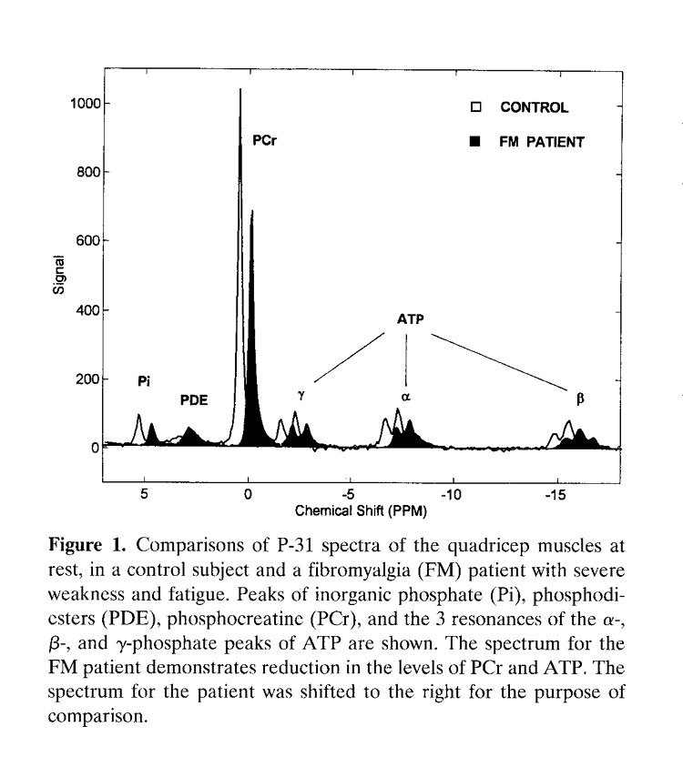 In this they used 31P-MRS to show a  baseline PCr between controls & those with fibromyalgia by ~15% &  ATP levels. At rest & exercise, their energy reserve (phosphorylation potential) & maximal workload was lower. They did find an inverse relationship between ATP & pain.