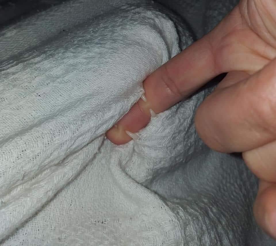 เตือนภัยค่ะ สำรวจผ้าห่มก่อนห่มกันด้วยนะคะ ไม่แน่ใจว่ามีพิษมั้ย