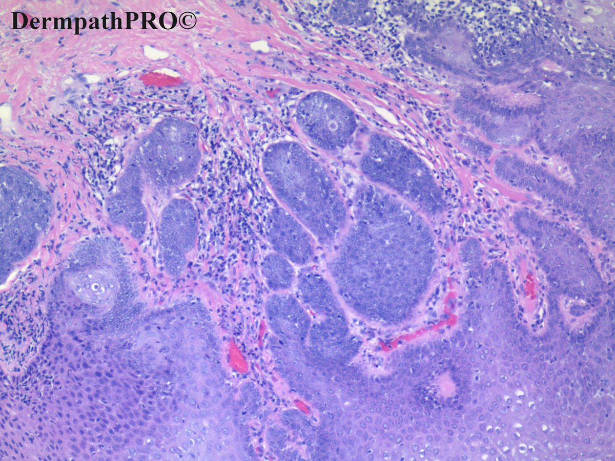 DermpathPRO tweet media